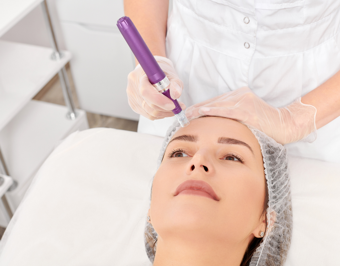 Micro Needling Razor Signature Micro Needling – Refined Rejuvenation